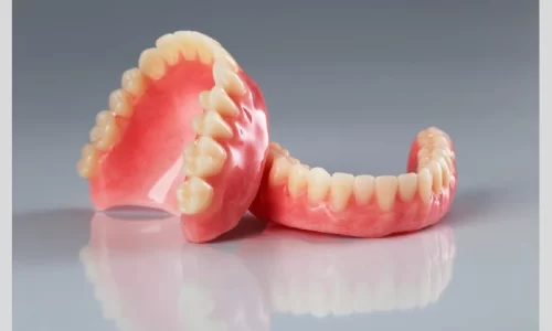 Full-mouth-rehabilitation-3-copy-1-7-5-2